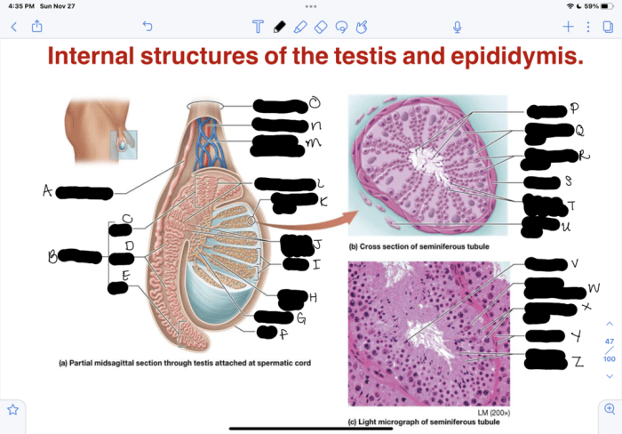 Art-labeling activity: internal structures of the testis and epididymis